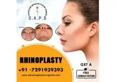 Rhinoplasty Surgery in Delhi