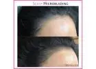 Microblading For Scalp Hair Loss