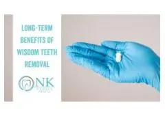 Wisdom Teeth Removal in Chicago
