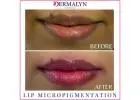 Lip Micropigmentation